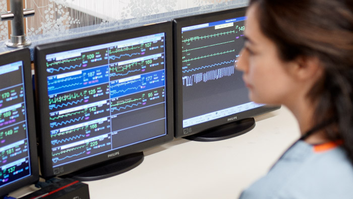 Miniatuur Wat leidt tot alarmmoeheid?