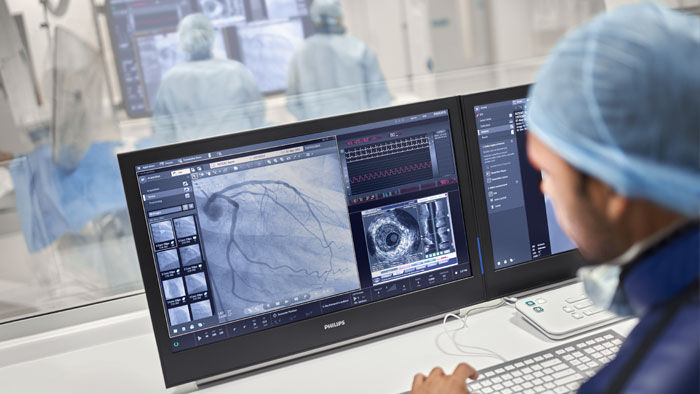 Percutane coronaire interventie