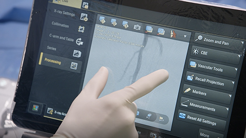 Pr&eacute;sentation de Philips Azurion nouvelle g&eacute;n&eacute;ration pour la radiologie interventionnelle