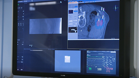 T&eacute;moignage client Philips Azurion&nbsp;7 C20 St. Antonius Nieuwegein, Pays-Bas