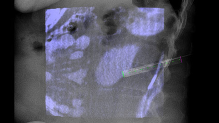 Guidage de trajectoire en temps r&eacute;el avec XperGuide