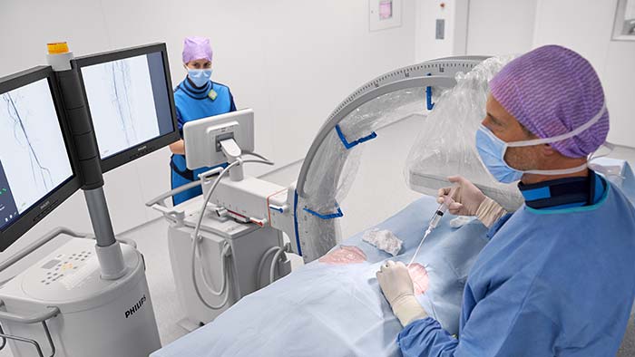 Mobiele C-bogen voor vasculair