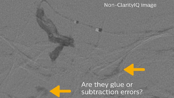 Lijm en subtractiefouten