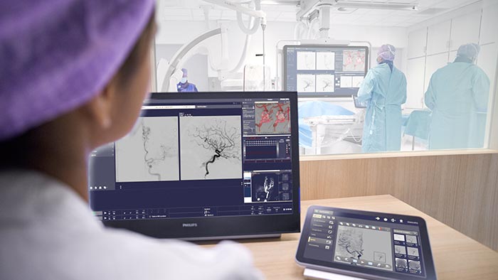 Neurovasculaire zorg