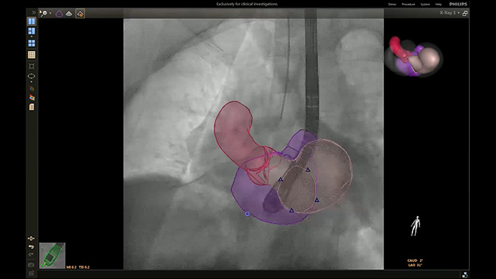 Mod&egrave;les EchoNav gauche followC