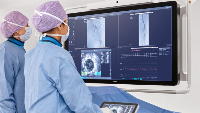 Traitement des malformations artério-veineuses