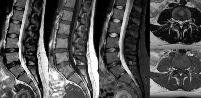 Miniature &ndash; Huit minutes