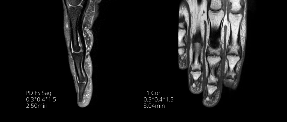 Miniature &ndash; Deuxi&egrave;me image