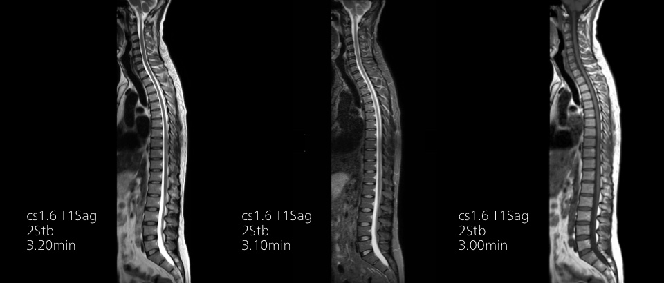 Miniature &ndash; Troisi&egrave;me image