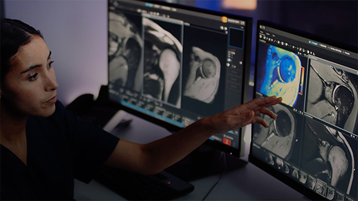 Miniature Qualit&eacute; d&rsquo;image