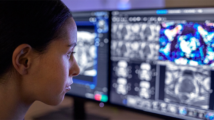 D&eacute;couvrez les avantages que MR&nbsp;Workspace peut apporter &agrave; votre service de radiologie