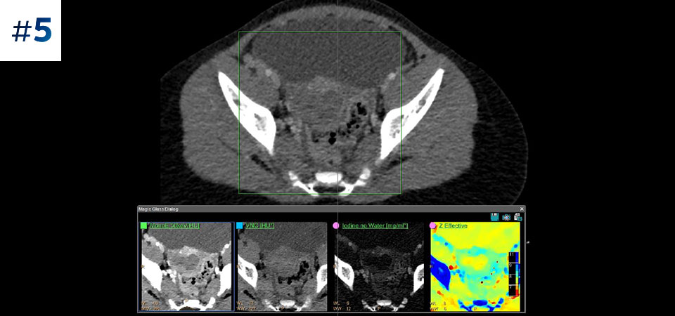 Abdomen p&eacute;diatrique