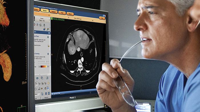 Tomodensitom&eacute;trie &agrave; d&eacute;tection spectrale