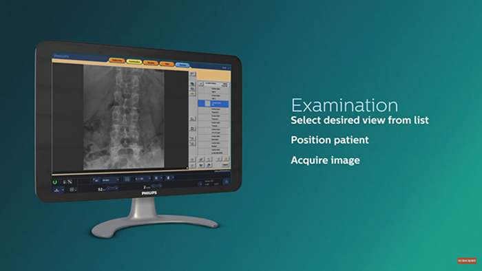 Le processus de travail Eleva optimise l&rsquo;imagerie