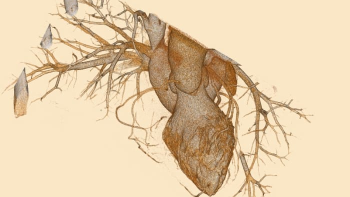 Foto van artsen die overleggen over CT-resultaten op een computermonitor