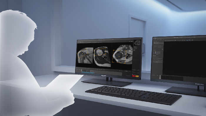 Planification et acquisition automatis&eacute;es