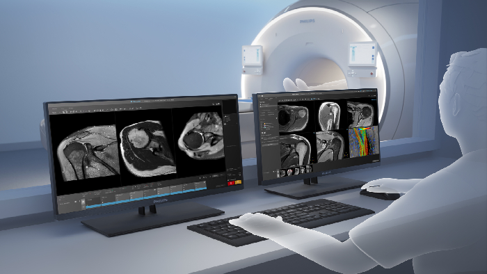 Post-traitement automatis&eacute;