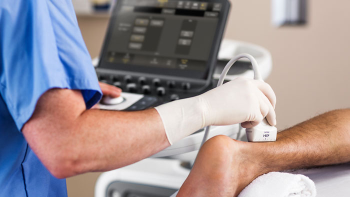 &Eacute;lastographie par ondes de cisaillement