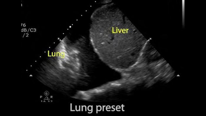 Pati&euml;nt die wordt behandeld
