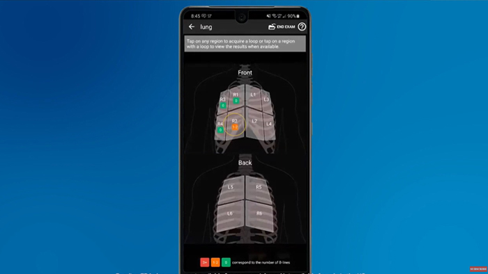 Hulpmiddel Pulsed Wave Doppler