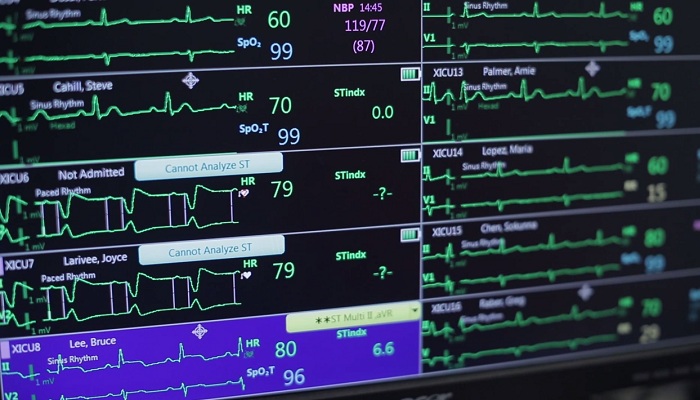 Solutions de gestion des alarmes &agrave; votre service