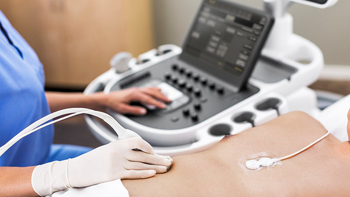 &eacute;chographe EPIQ&nbsp;7