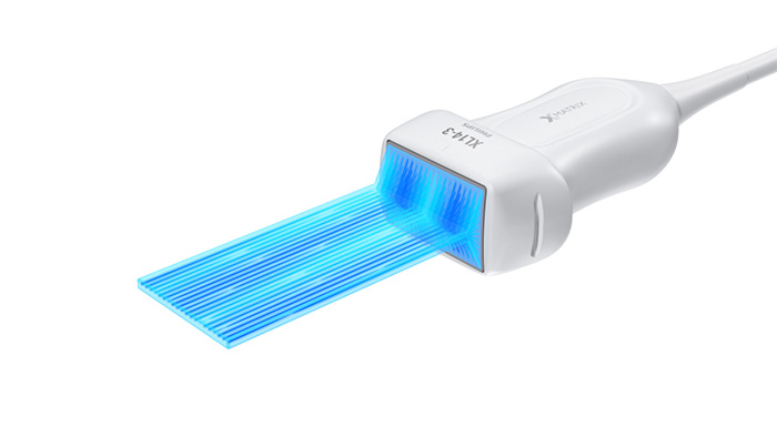 &eacute;chographe EPIQ&nbsp;7