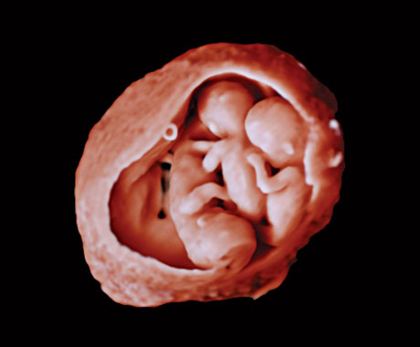 truevue-source-lumi&egrave;re-gauche-inf&eacute;rieure-tripl&eacute;s