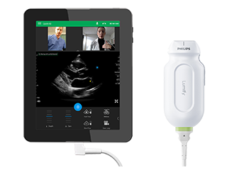 Epiq 7-echografiesysteem